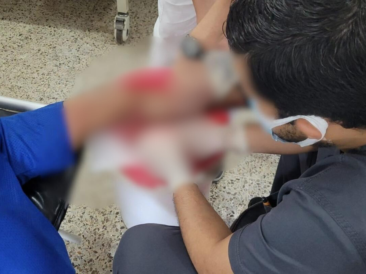 Hospitalizan a hombre tras ser atacado por un cerdo en Olancho