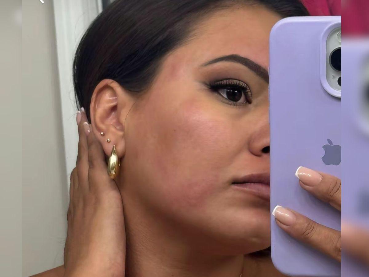 Alejandra Rubio reaparece con la cara inflamada, ¿qué le pasó?