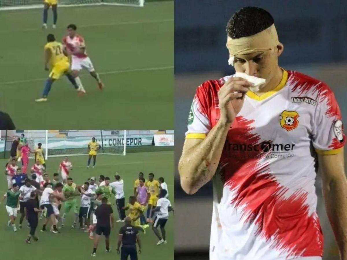 Año para el olvido: Las polémicas que hundieron al deporte hondureño en 2025