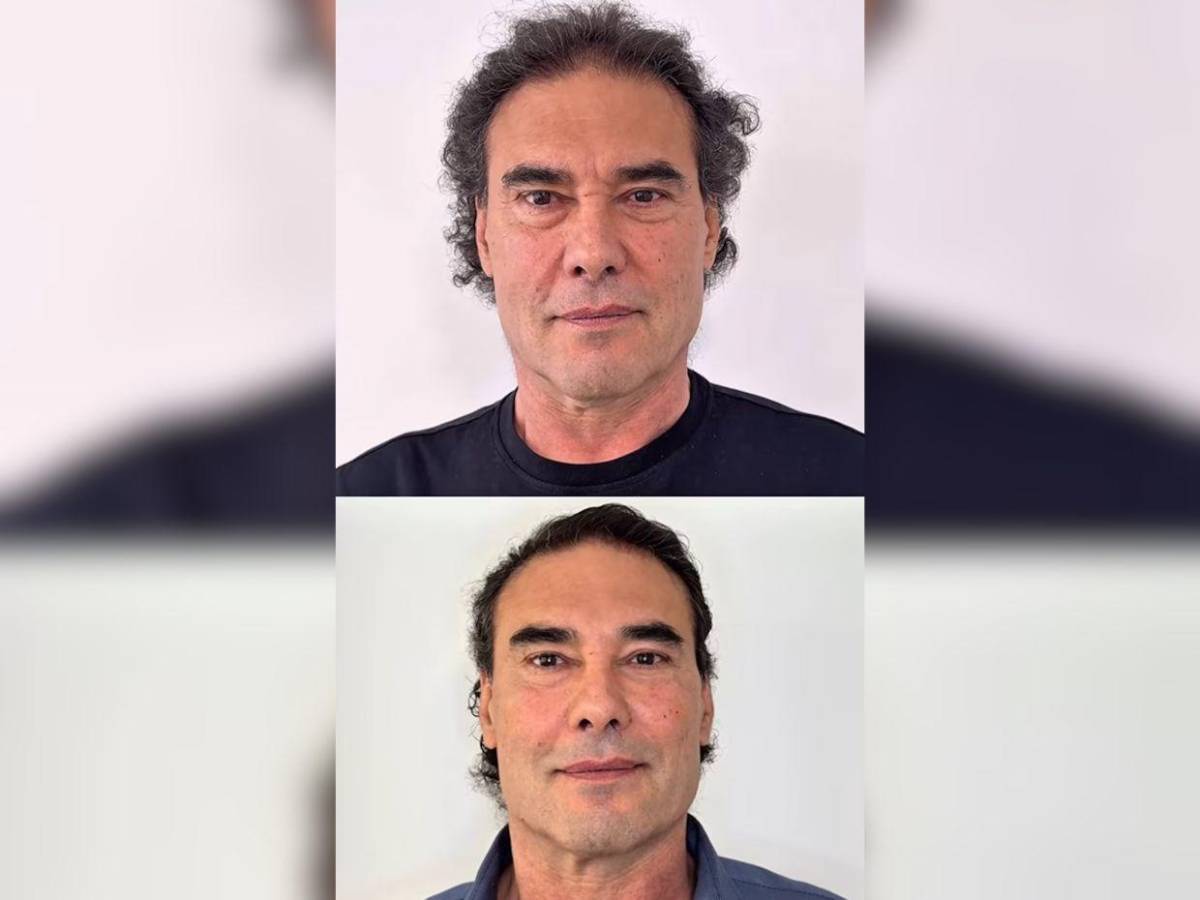 Así luce Eduardo Yáñez tras su procedimiento de rejuvenecimiento