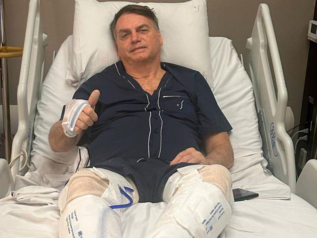 Expresidente Bolsonaro recibe alta tras “excelente recuperación” de cirugías