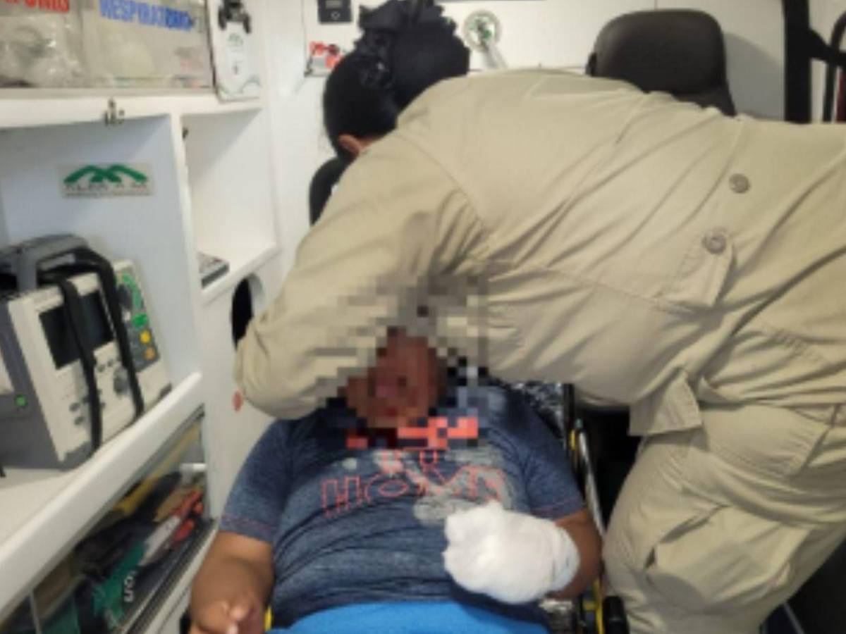 Más de 10 quemados por pólvora se registraron durante las fiestas de Fin de Año