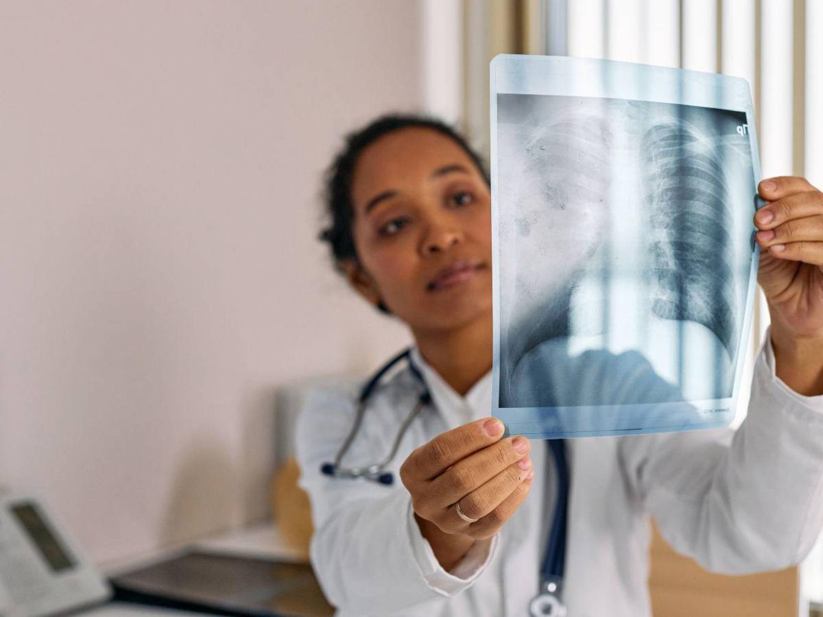 El cáncer de pulmón que afecta al papa León XIV: qué es el adenocarcinoma y cómo se trata