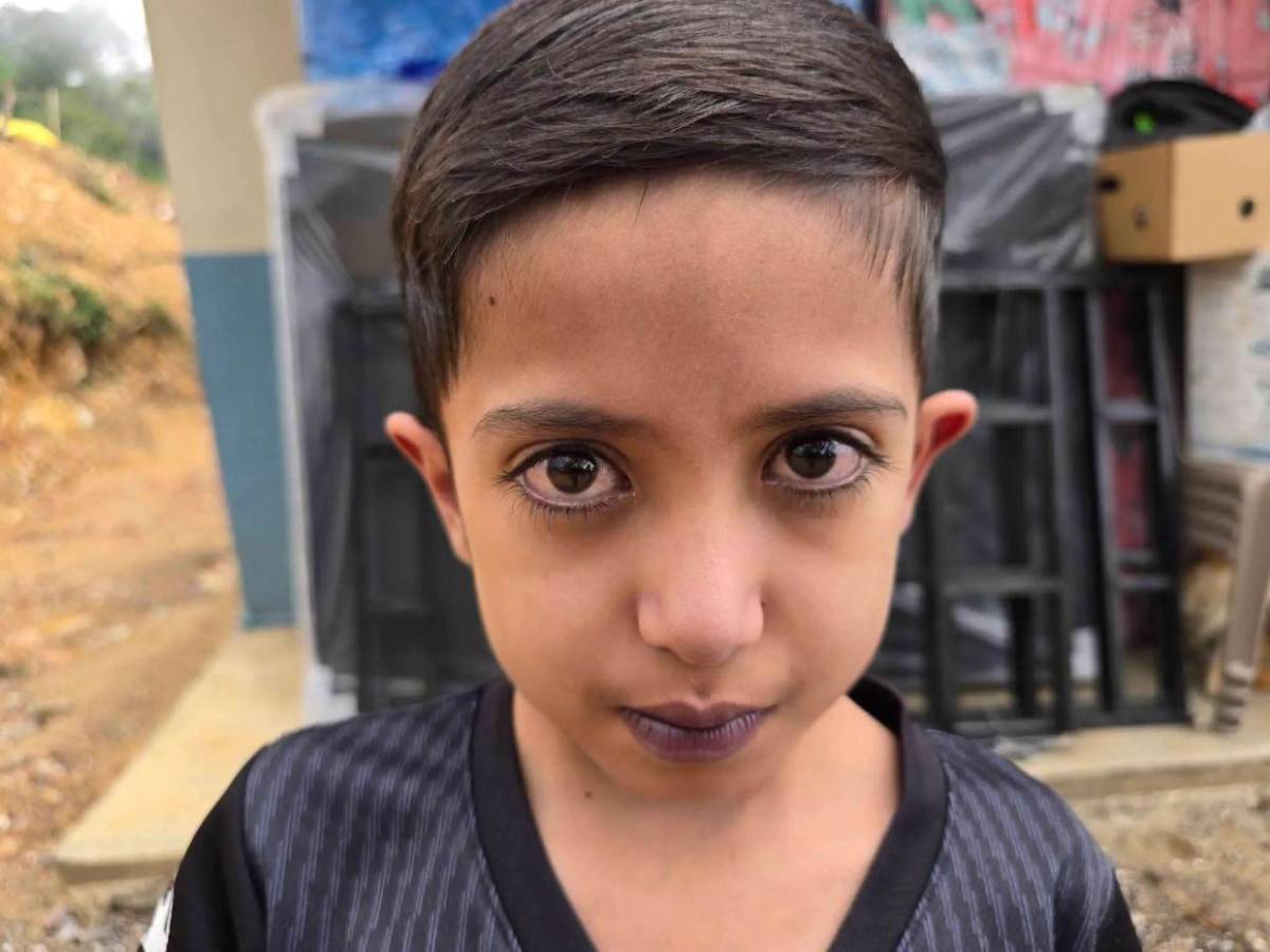Josué, el niño con el corazón en el lado derecho y cardiopatía; El Salvador  extenderá ayuda