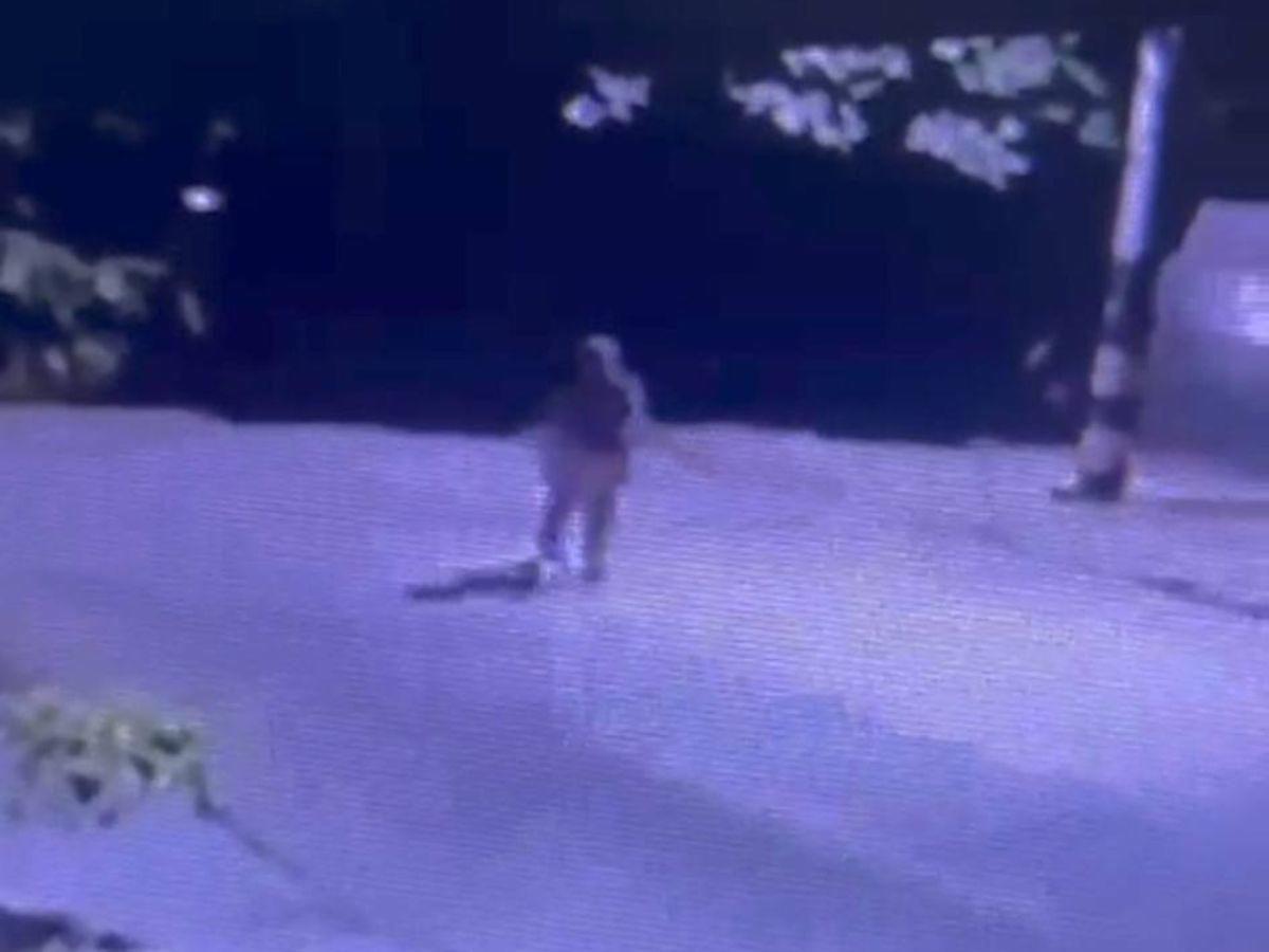 Recibió 30 machetazos: Yensy Guzmán quedó completamente desfigurada tras brutal ataque de su esposo