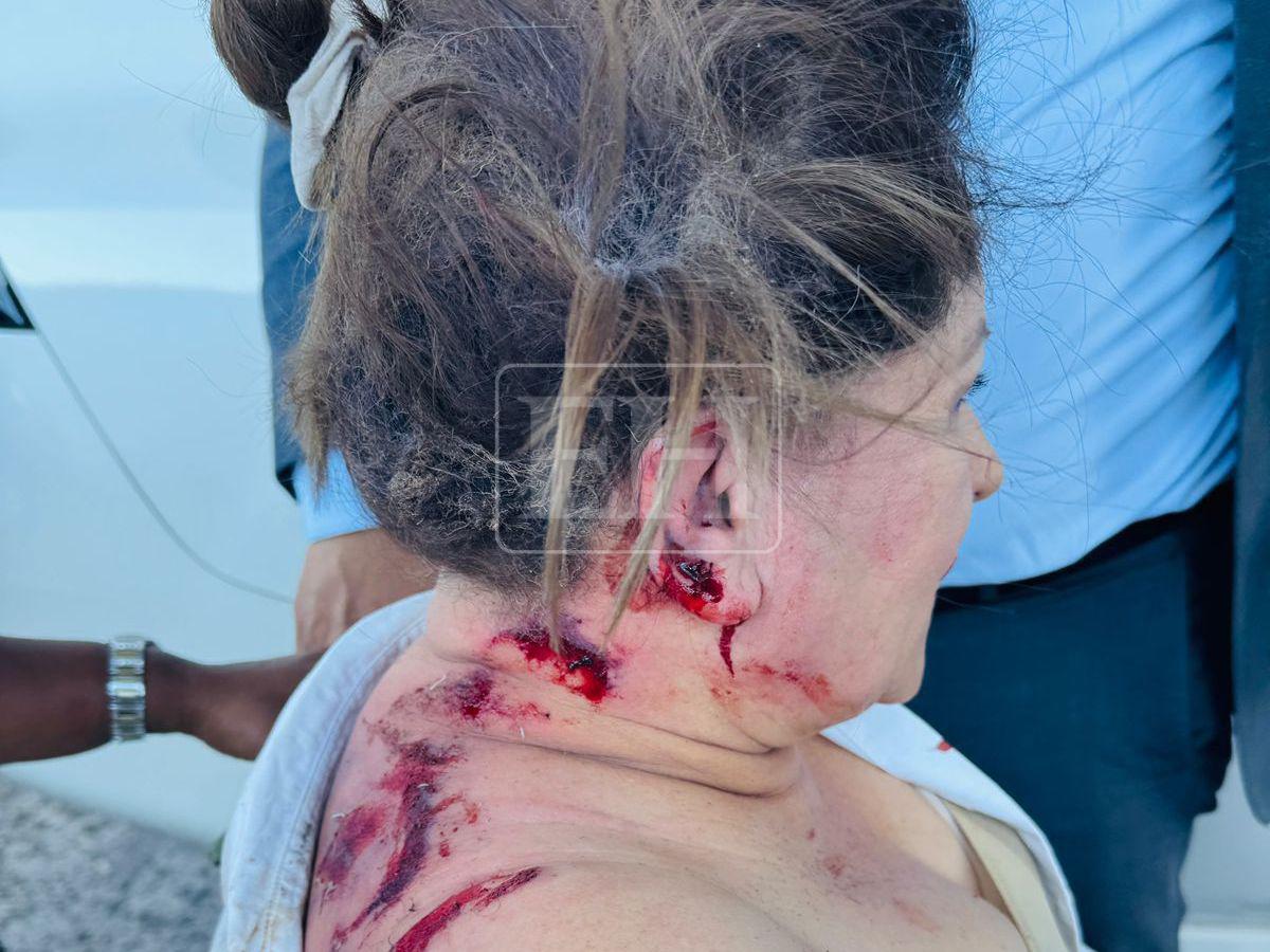 ¿Agresores de la diputada fabricaron el explosivo?: Nuevos detalles de la Policía sobre el atentado