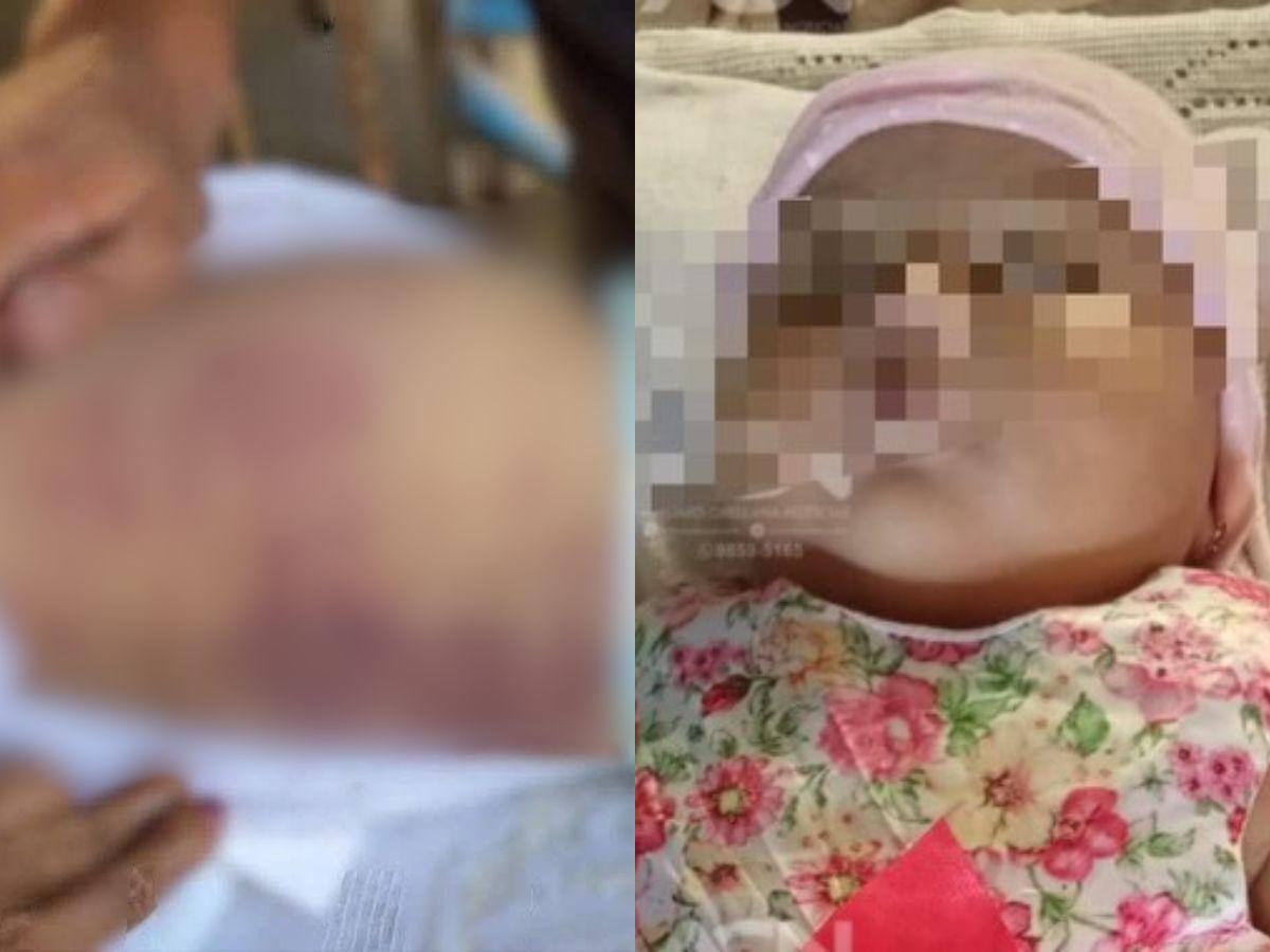 Investigan muerte de bebé de seis meses tras ser vacunada en La Ceiba: cronología del caso