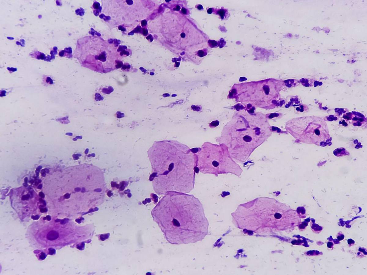 Eva Gallegos: Científica que erradicó el VPH al 100% en 29 mujeres