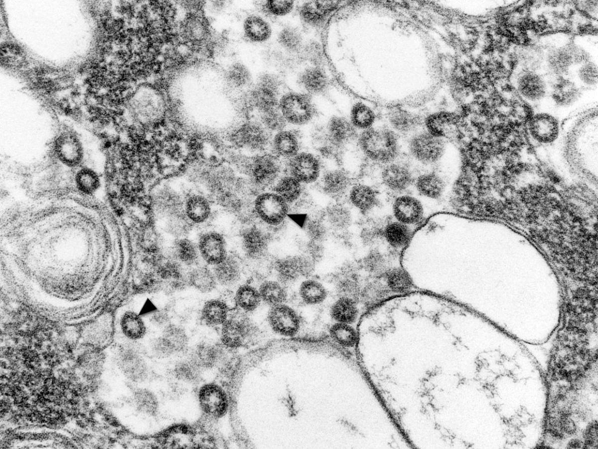 Eva Gallegos: Científica que erradicó el VPH al 100% en 29 mujeres