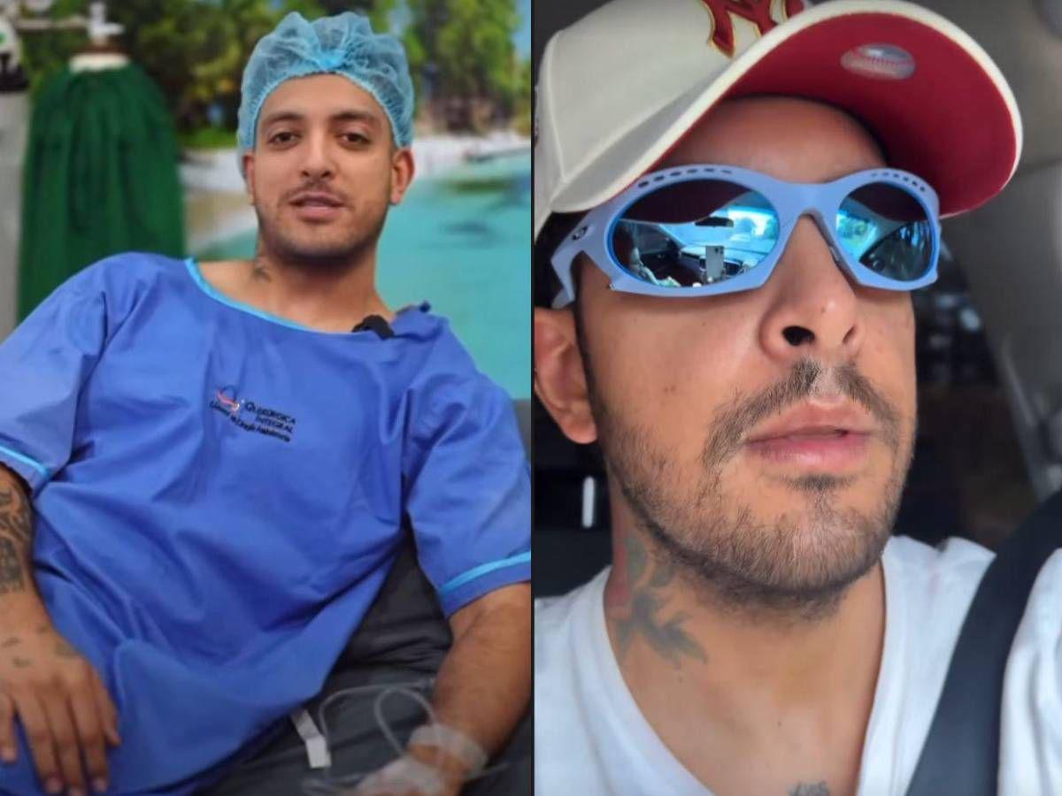 La operación que le cambió la vida: Fancony revela cuánto pagó por su transformación