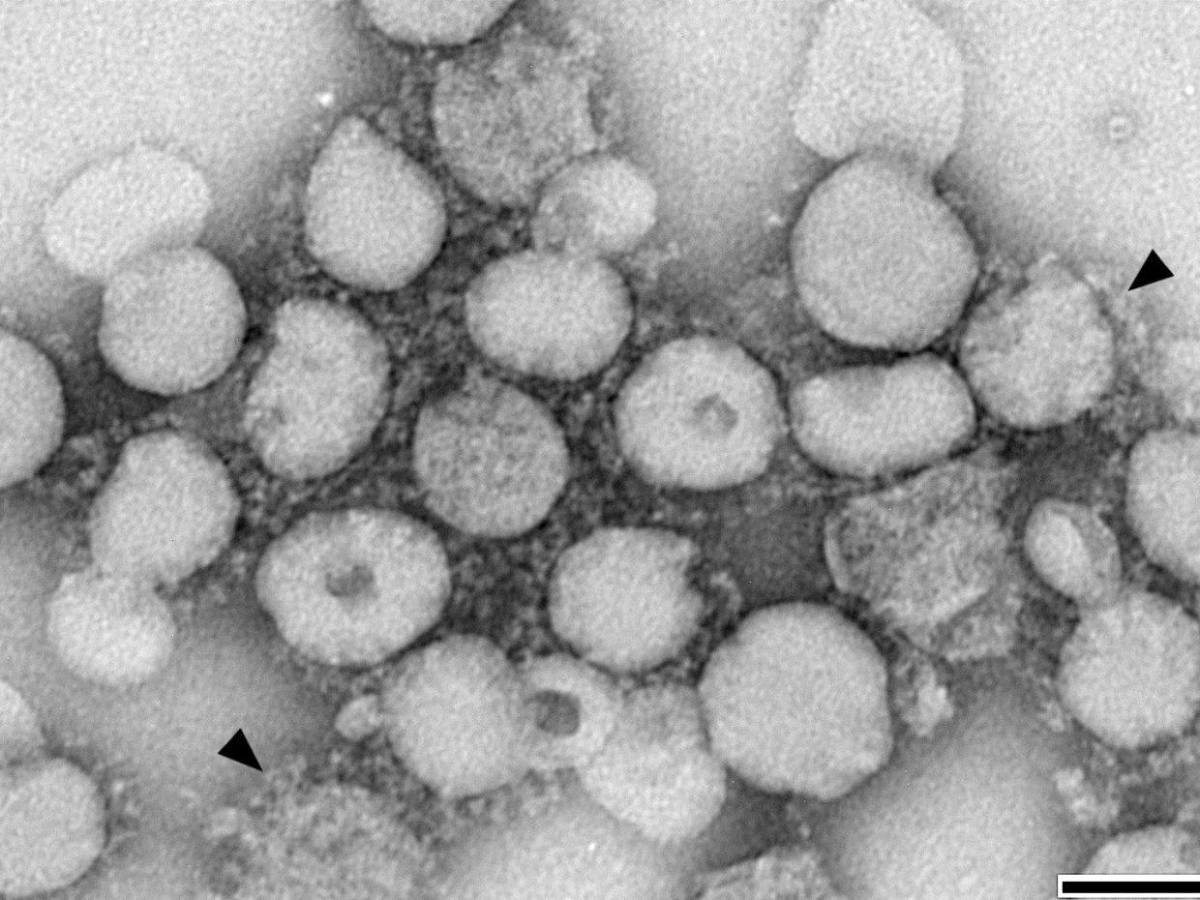 Eva Gallegos: Científica que erradicó el VPH al 100% en 29 mujeres