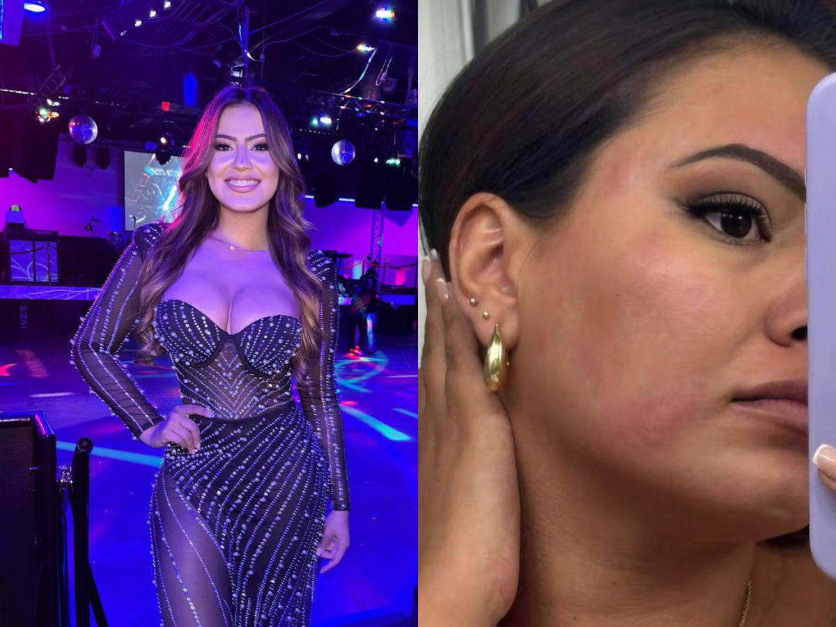 Alejandra Rubio reaparece con la cara inflamada, ¿qué le pasó?