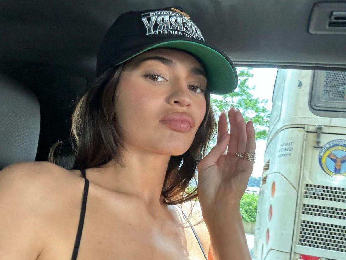 Kylie muestra su rostro natural tras disolver la mitad de su relleno de labios Kylie muestra su rostro natural tras disolver la mitad de su relleno de labios