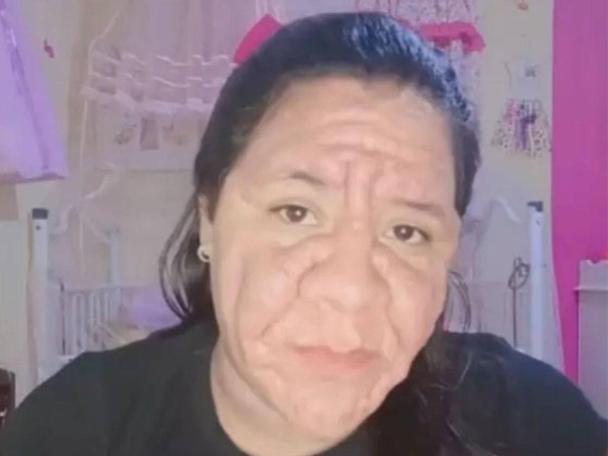 Joven con 8 meses de embarazo enfrenta deformación facial tras error médico