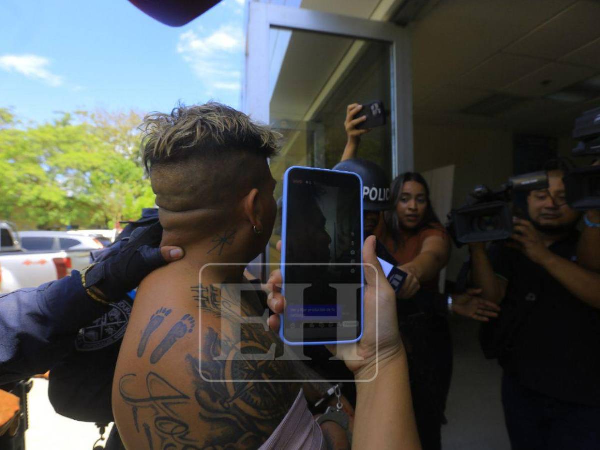 Supuesto líder de “La Kleivona” llega herido a la DPI y niega ser delincuente