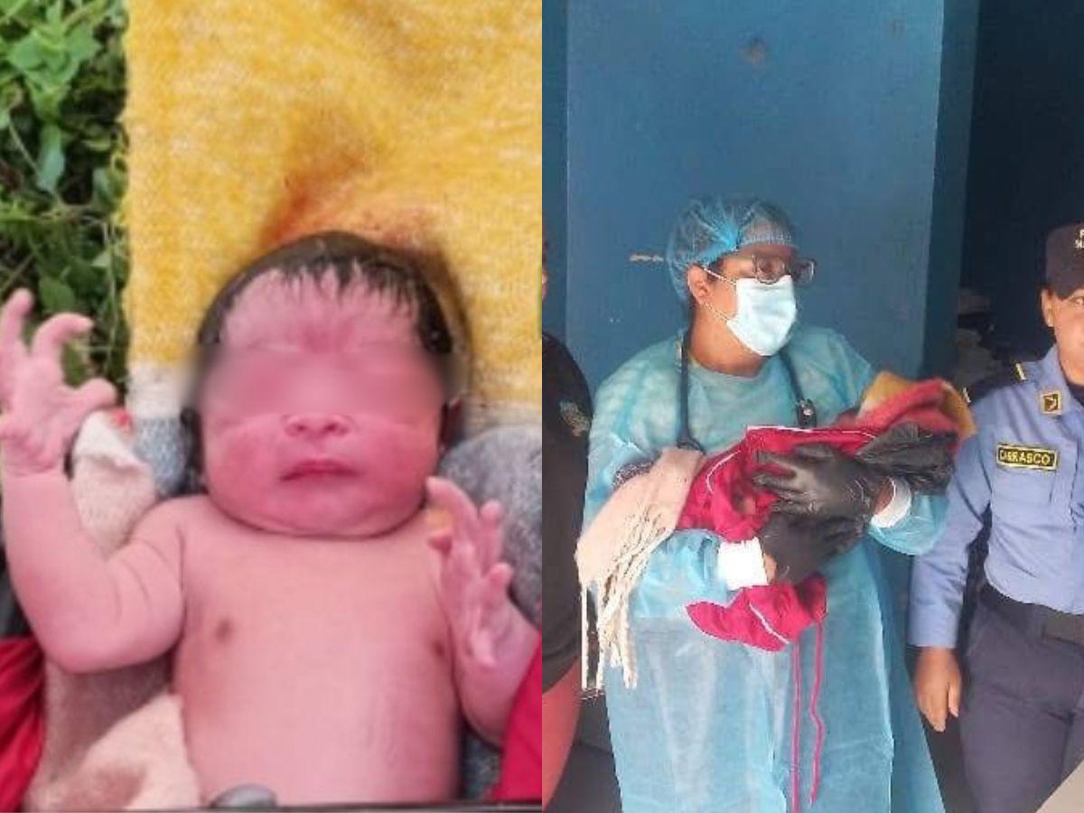 Bebé abandonado en una bolsa negra en Lepaterique: ¿Qué se sabe de su estado de salud?