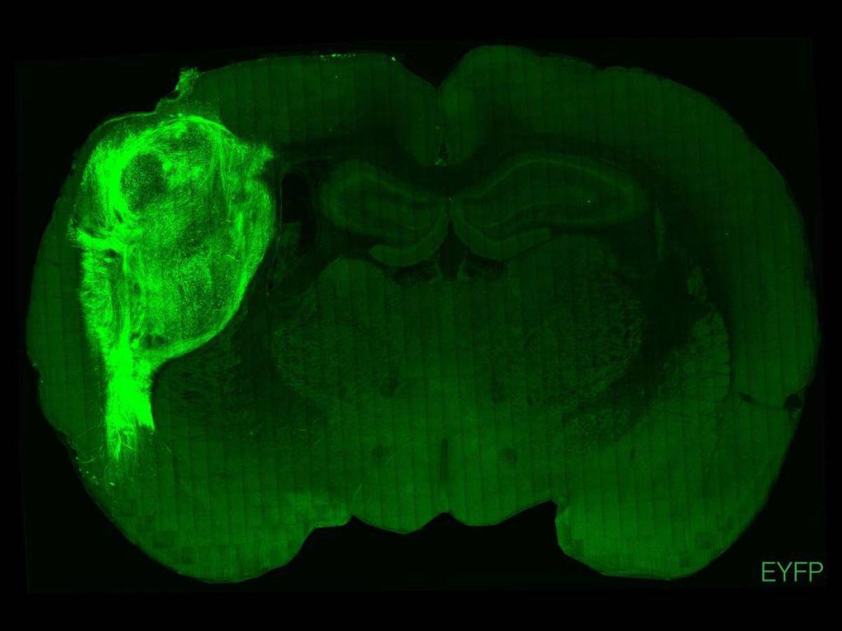 Implantan células cerebrales humanas en ratas para estudiar enfermedades psiquiátricas