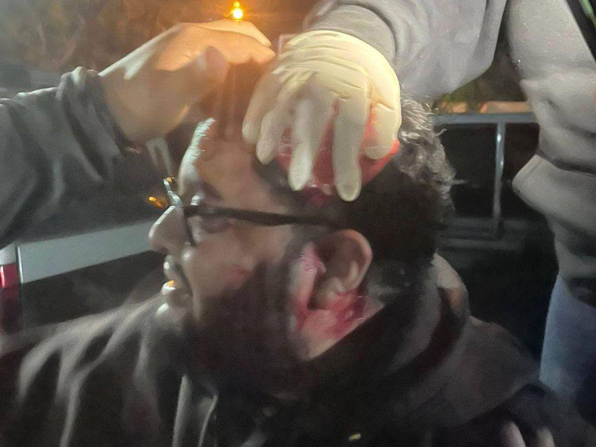 No puede caminar: Violentos disturbios en el Infop dejan varios heridos de gravedad