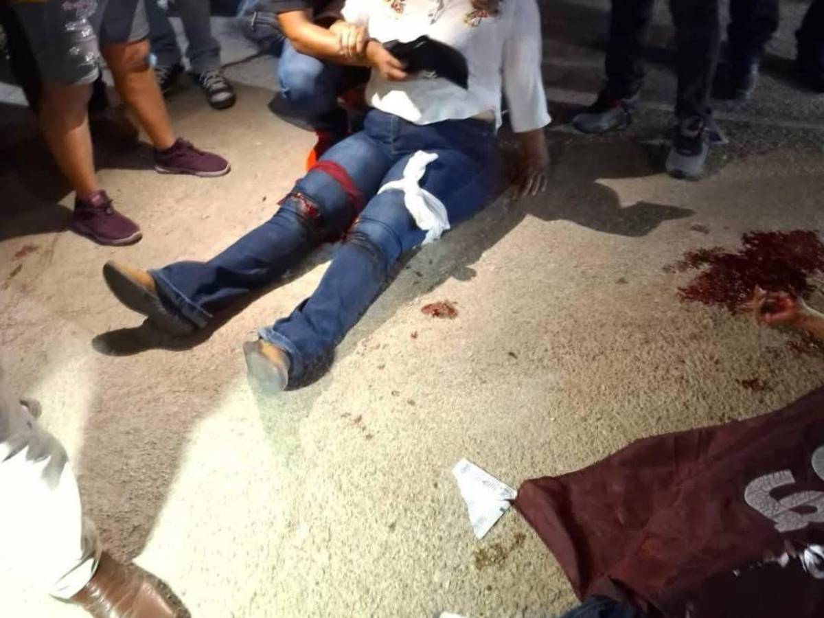 Unos 20 disparos, 4 muertos y 3 heridos: minutos de terror en mitin en México