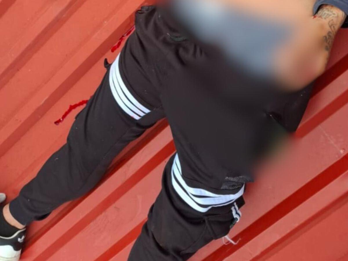 Tenía el número 18 tatuado en el pecho: así fue la balacera en Ciudad España que dejó un muerto