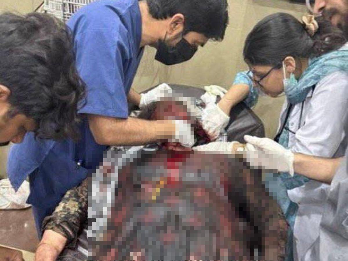 Misiles de India sobre Pakistán:  fotos de la destrucción y los heridos tras el ataque