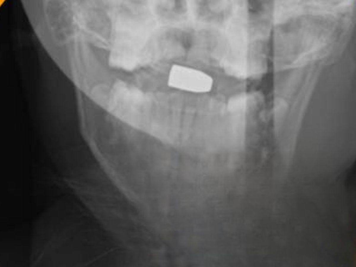 Emerson Villanueva, menor que habría muerto tras impacto de bala perdida en Lempira