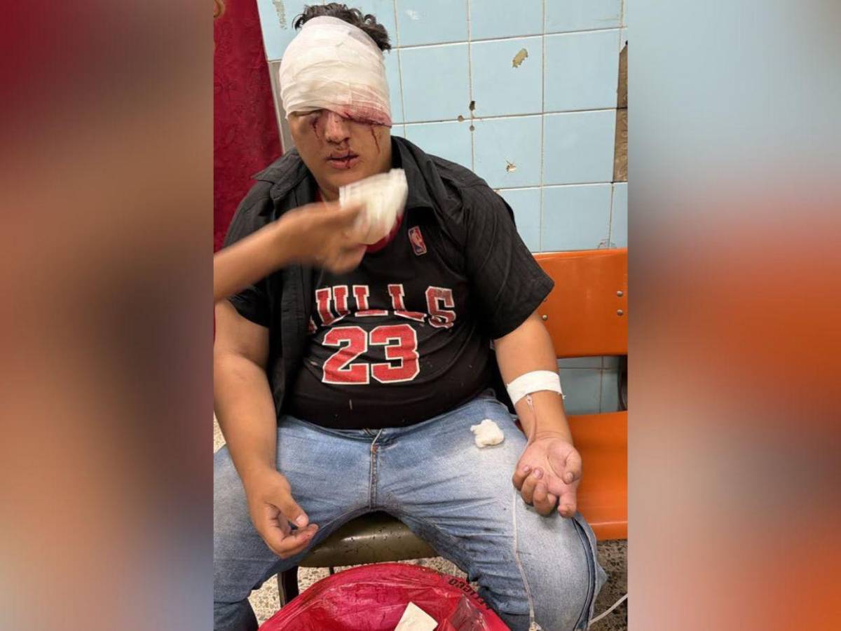 ¿Quién es el estudiante de la UNAH que perdió un ojo durante protesta en el Congreso?