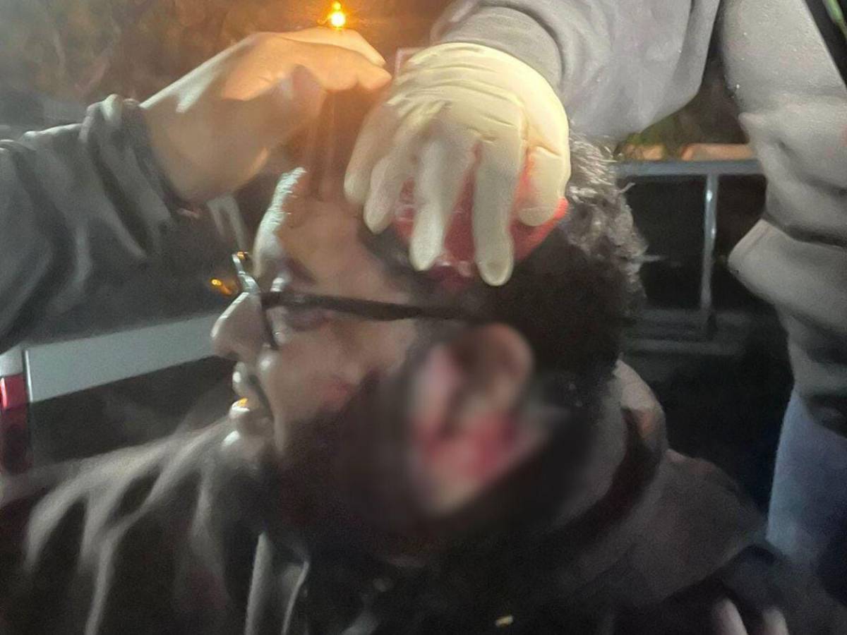 “Cuidado, ahí vienen las piedras”: así fueron los enfrentamientos en el Infop esta madrugada