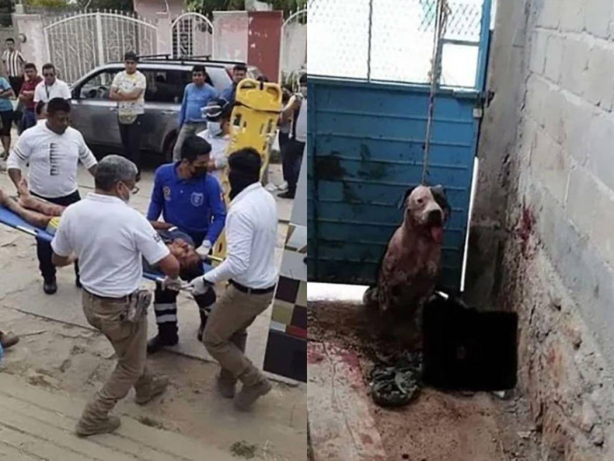 Ladrón casi pierde el brazo por un pitbull y ahora piden sacrificar al perro