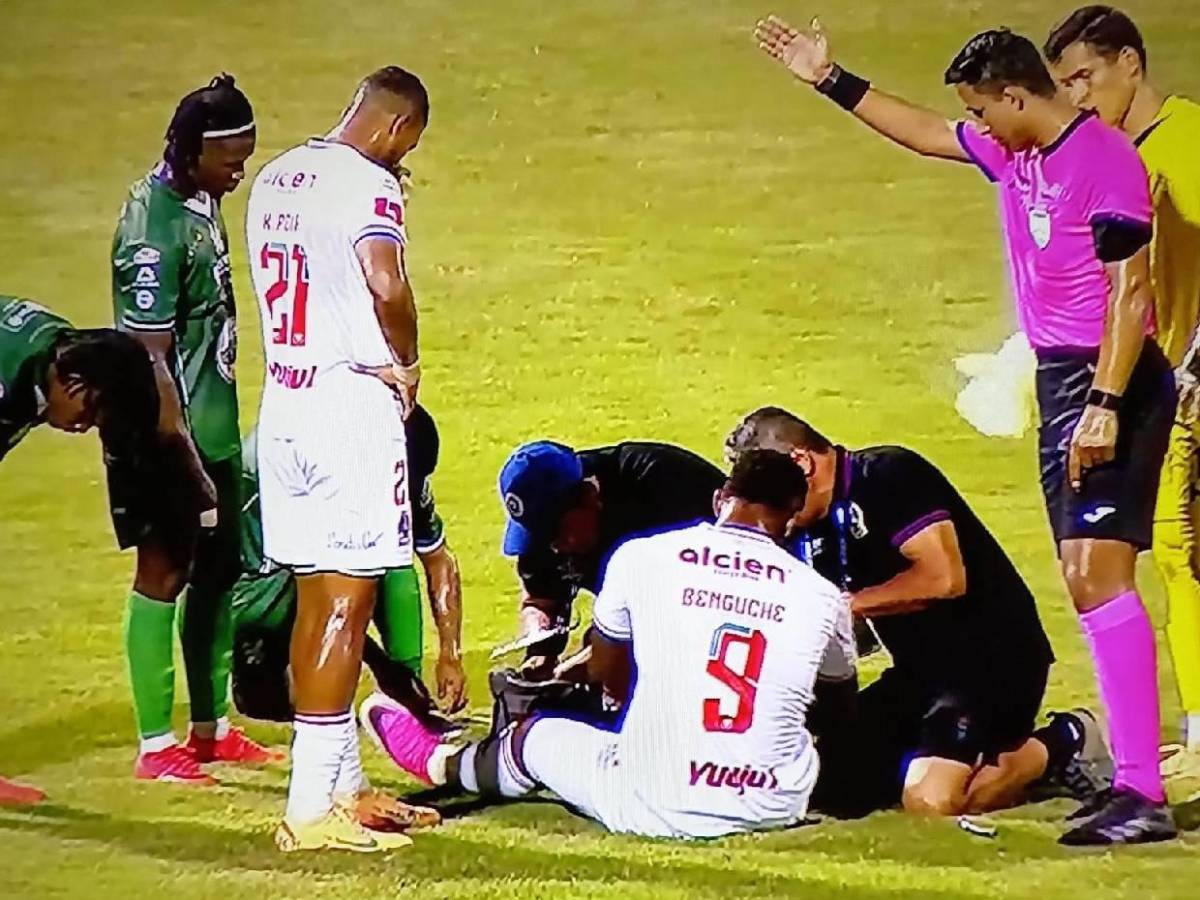 Chica sorprende a todos, Benguché preocupa, golazo de Puskas y Olimpia vapulea al Platense