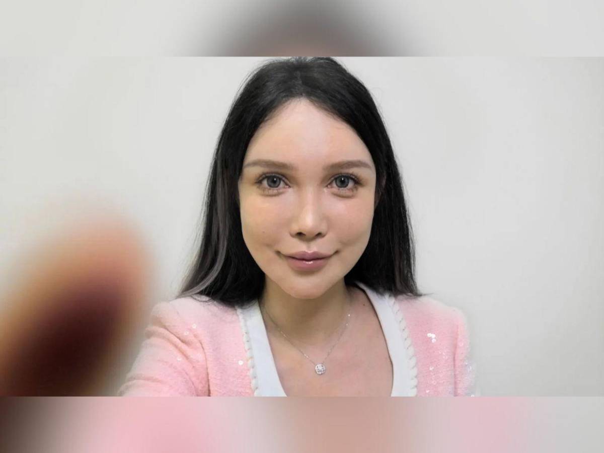 Abby Wu, la mujer que se ha hecho más de 100 cirugías: Nunca dejaré de hacérmelas