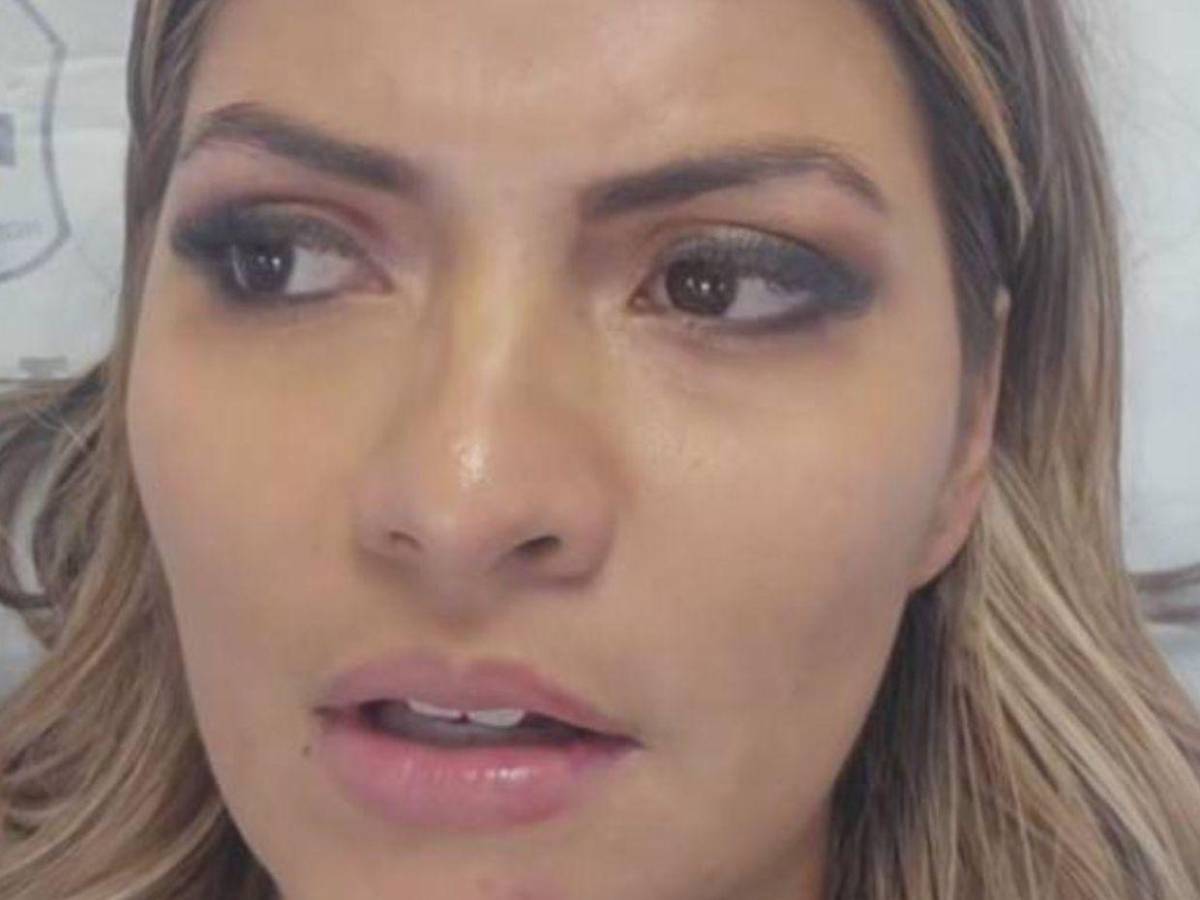 Saraí Espinal reaparece con collarín y moretones tras grave accidente vial