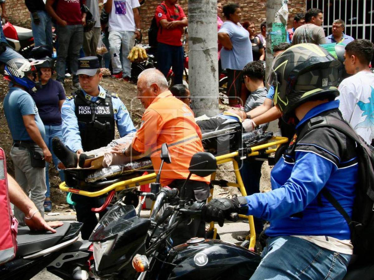 Por evitar atropellar una persona: motociclista queda muy herido en accidente en Tegucigalpa