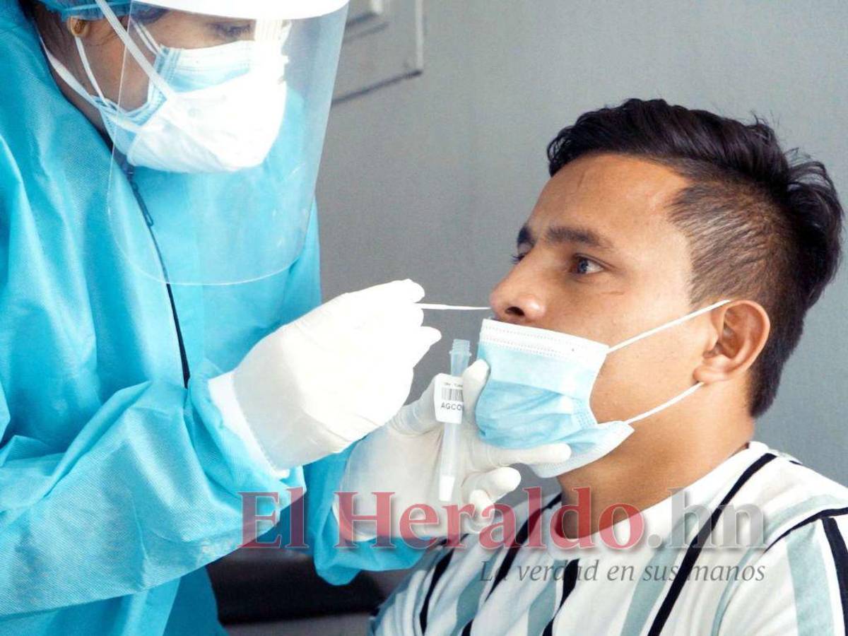 Solo se aplican pruebas de covid-19 a los pacientes con síntomas en Honduras