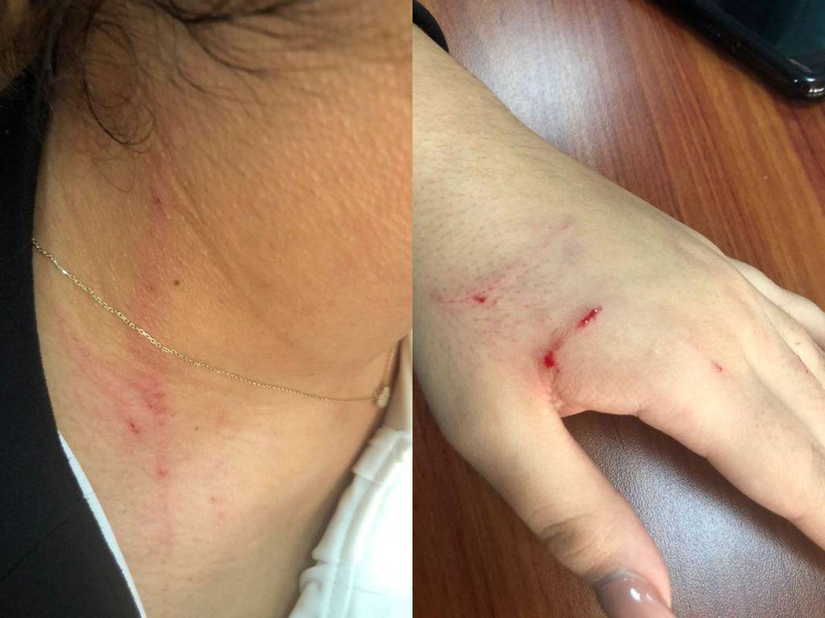 La asistente de cámara difundió estas fotografías tras el incidente.