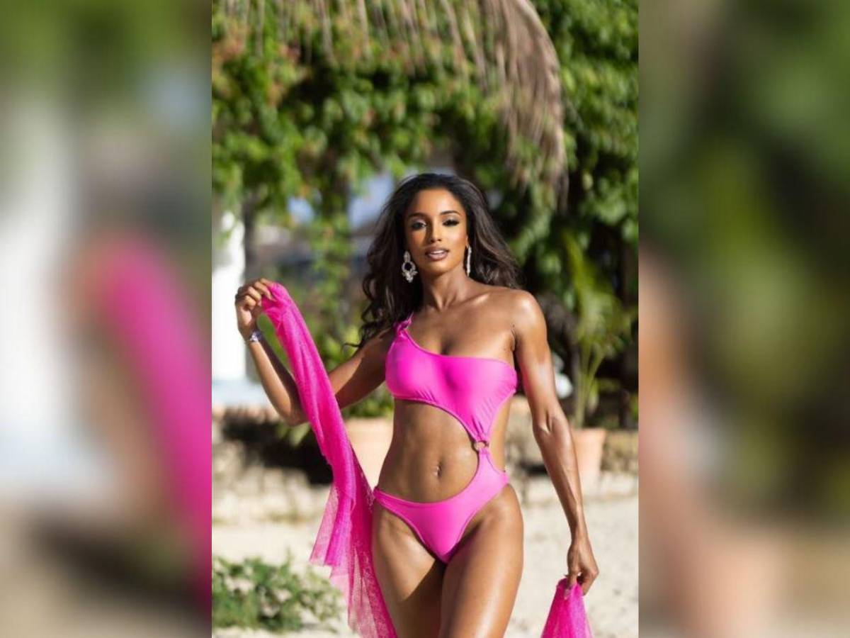 ¿Cuál es el estado de salud de Miss Universo Jamaica? Esto se sabe