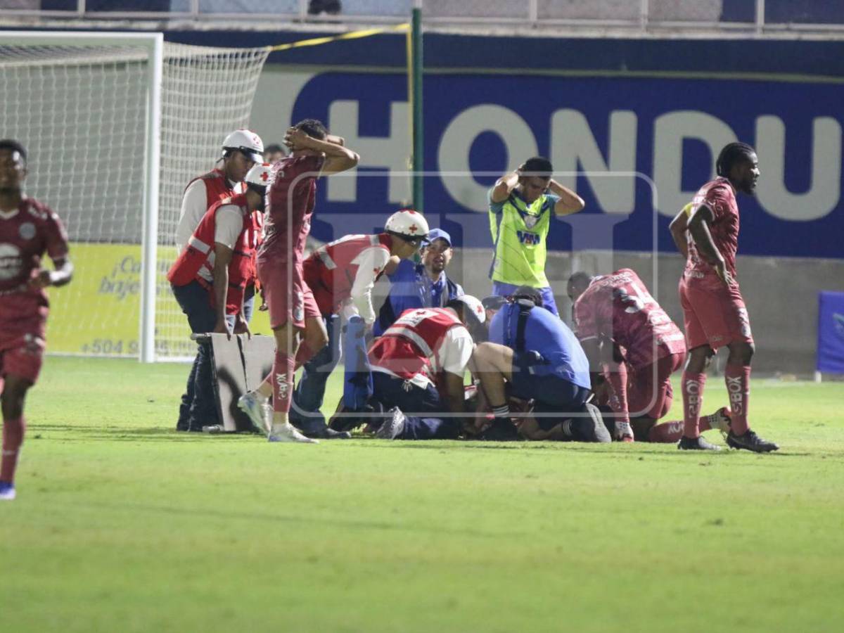 Romario da Silva, futbolista de Motagua, fue intervenido tras su fuerte lesión: ¿volverá a jugar?