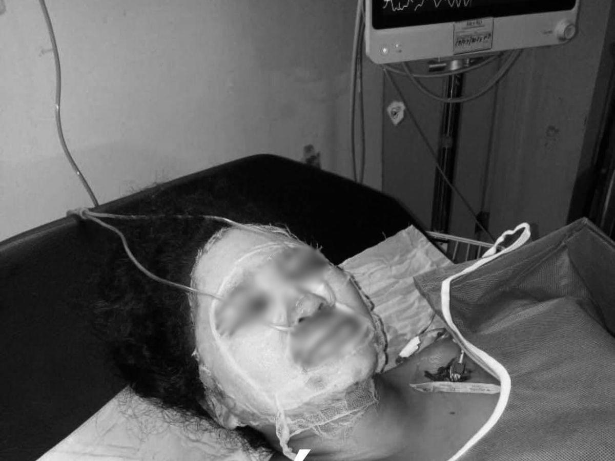 Deja dos pequeños: la explosión de un chimbo de gas le quitó la vida a Erika Torres