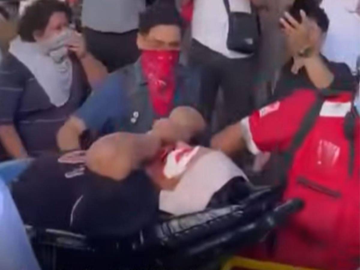 ¿Quién es el estudiante de la UNAH que perdió un ojo durante protesta en el Congreso?