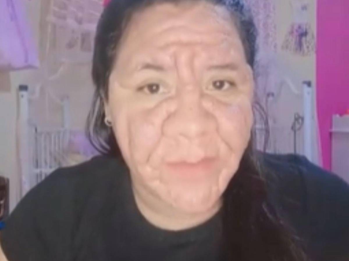 Joven con 8 meses de embarazo enfrenta deformación facial tras error médico