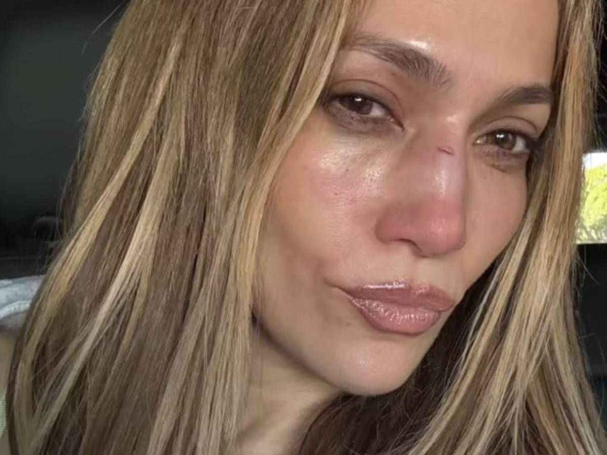 Jennifer López sufre lesión en el rostro tras un accidente en escenario