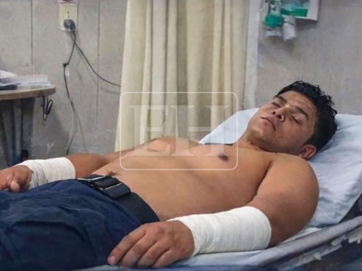 Heridas en el cuello y antebrazo: estado de salud de los policías heridos en La Masica