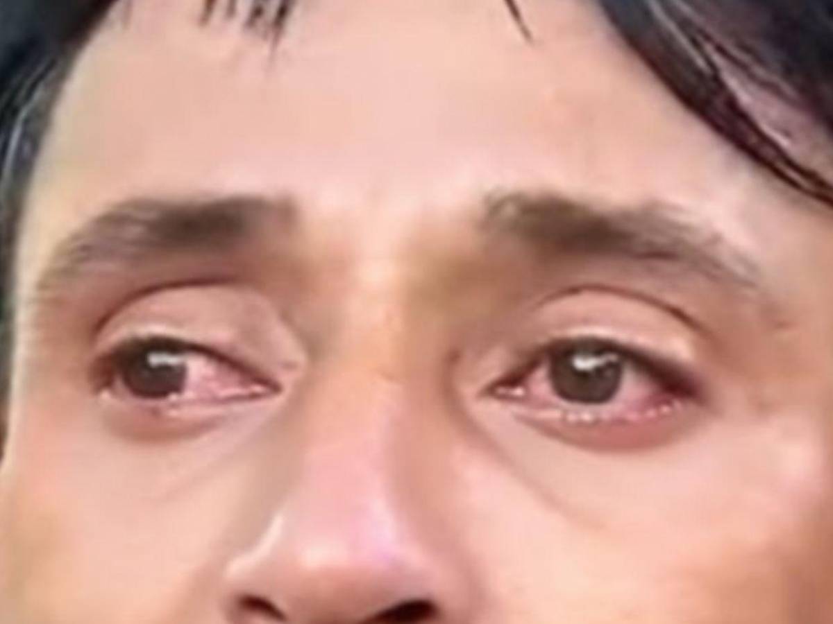 “Salí volando”: sobrevivientes relatan los momentos antes del accidente en Santa Bárbara