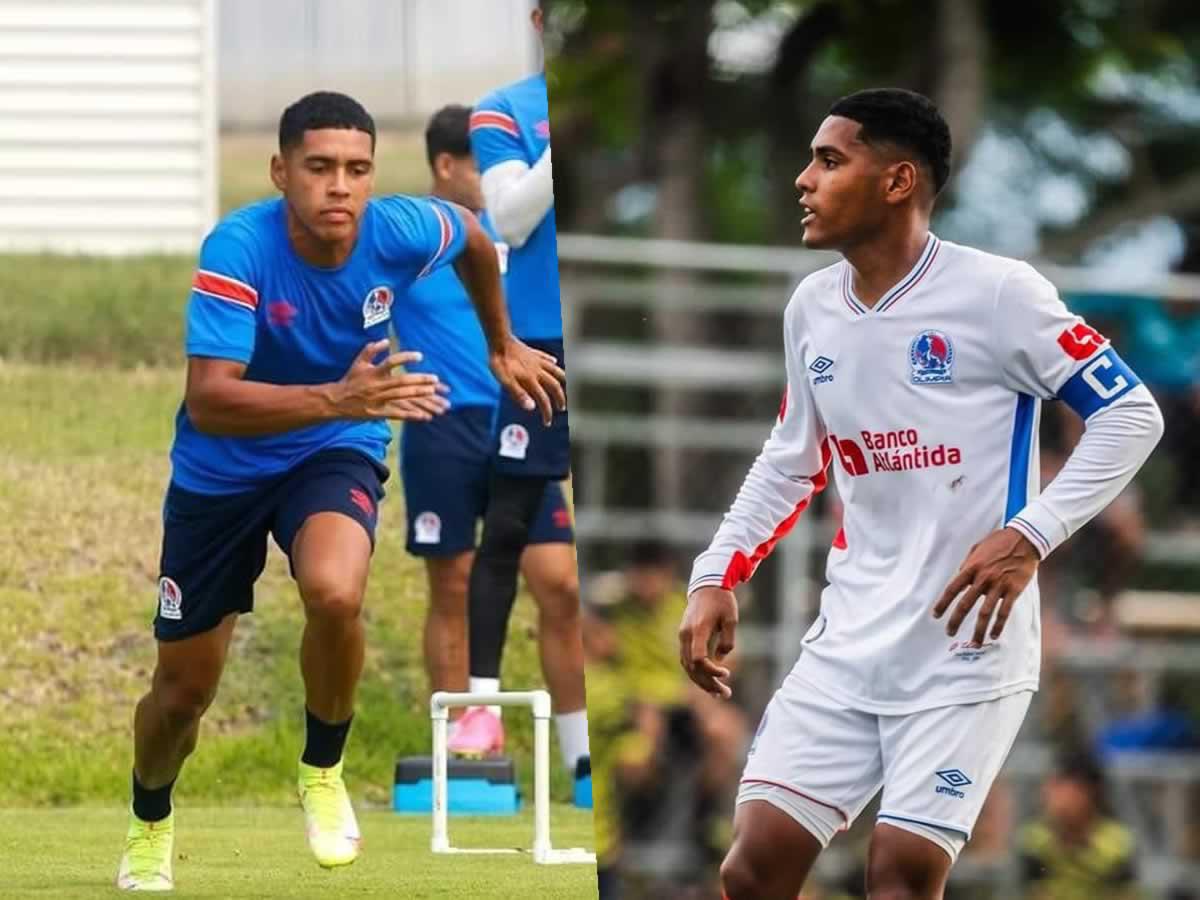 ¡Tres bajas! El modificado 11 titular de Olimpia para juego ante Juticalpa