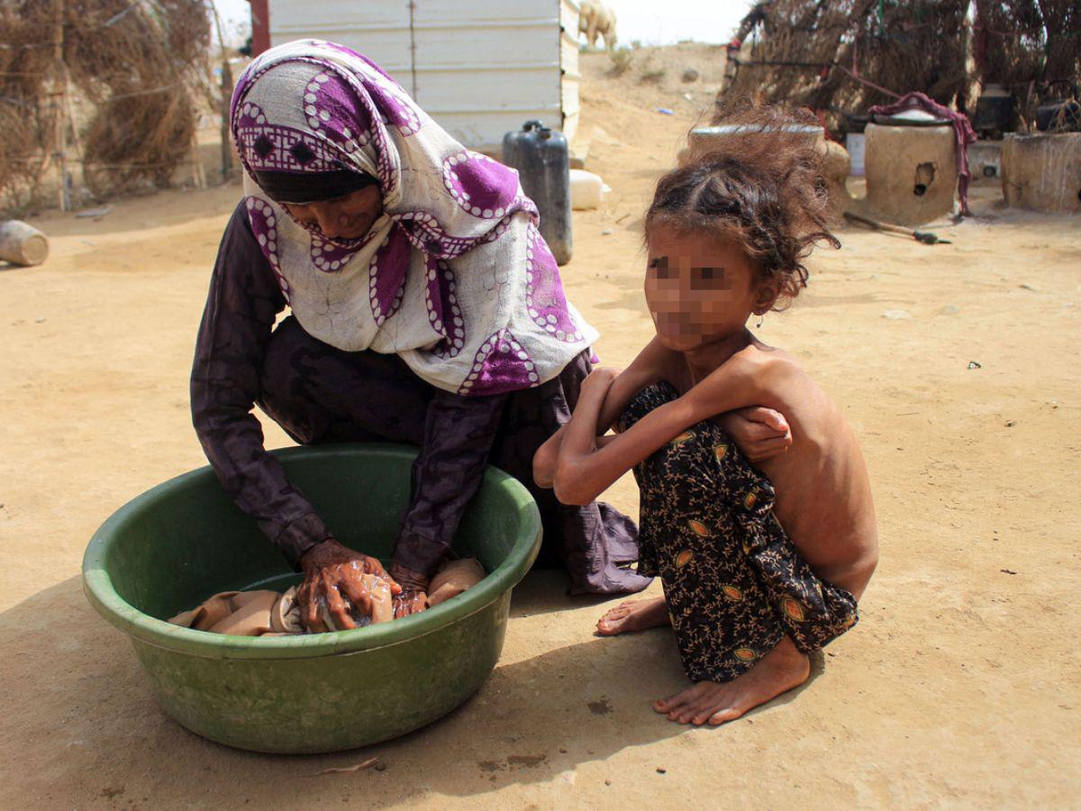Alertan sobre los efectos “irreversibles” de la desnutrición de mujeres y niñas