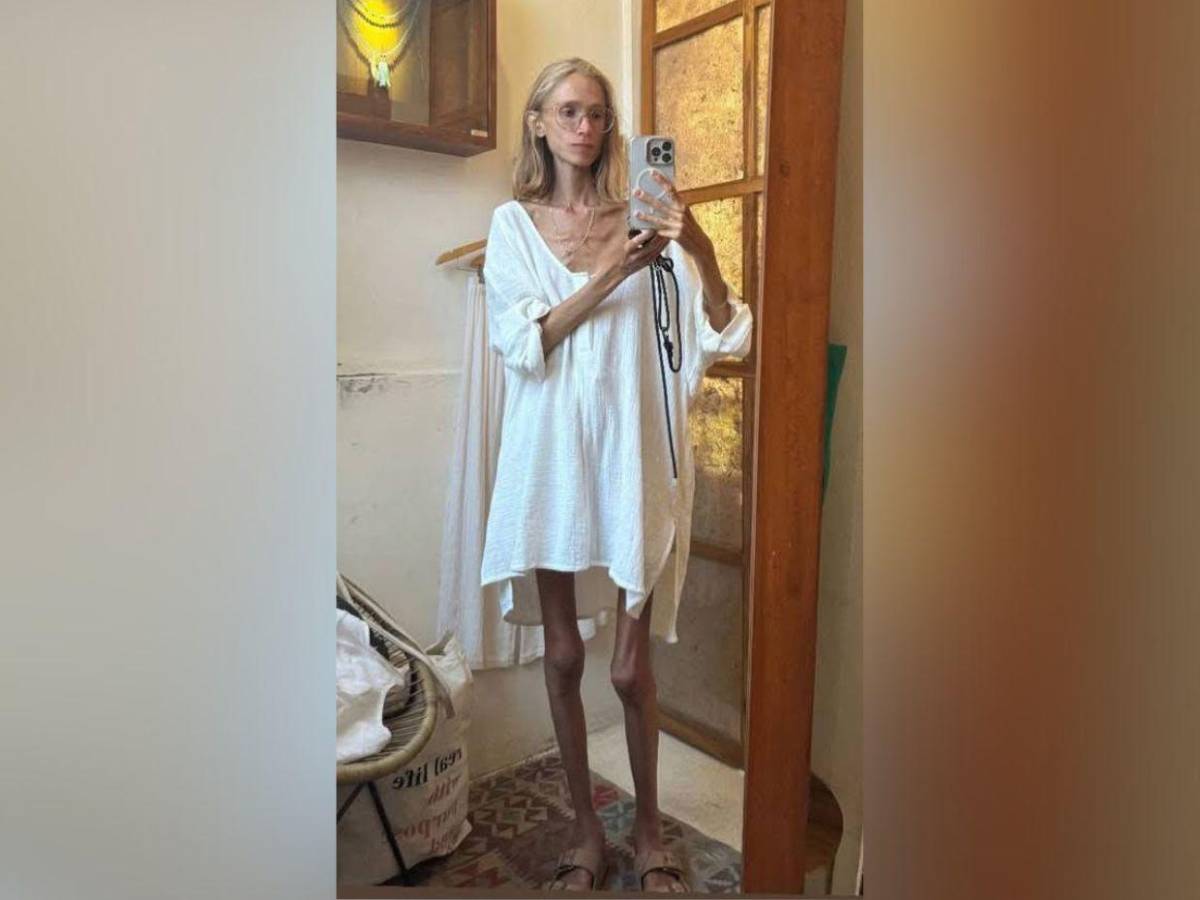 ¿Quién es Karolina, influencer que murió tras dieta basada solo en frutas en Bali?