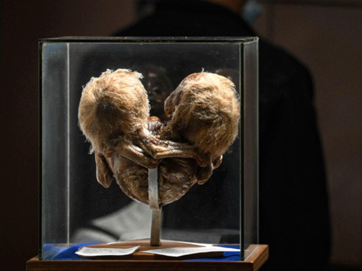 Museo en Colombia exhibe “tesoros macabros” del ser humano
