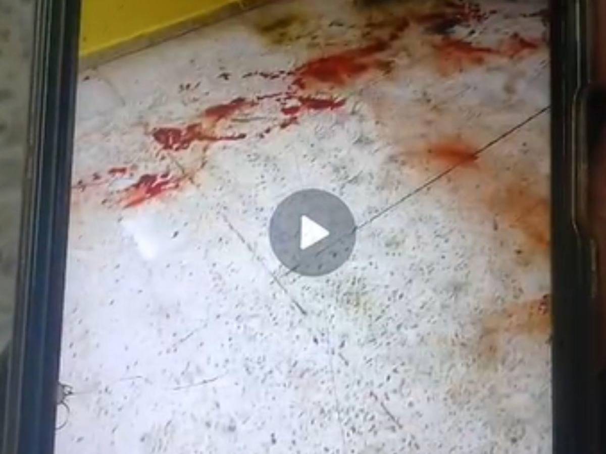 ¿Conflicto por una camisa? Estudiante de la UNAG fue apuñalado por su compañero