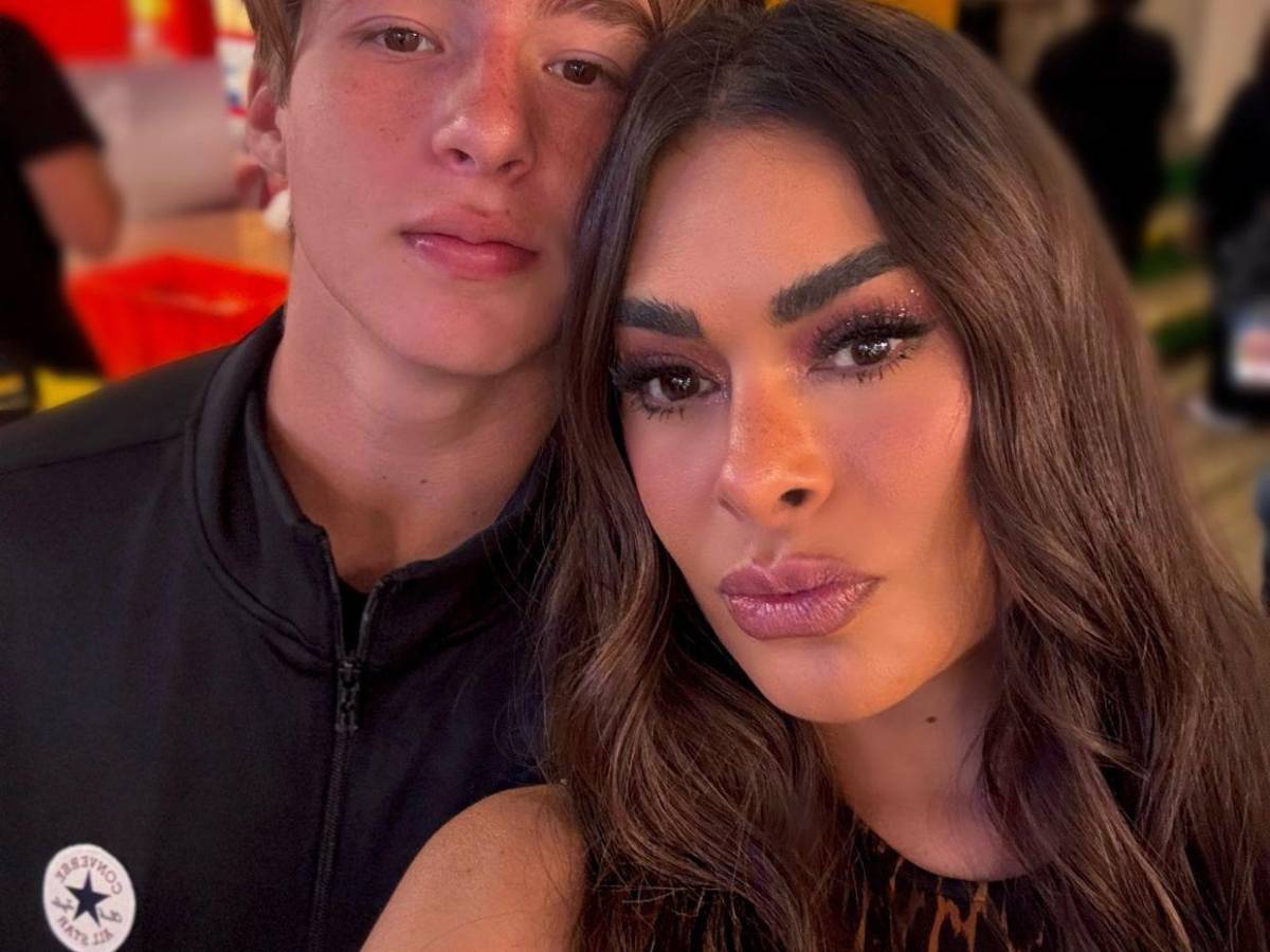 Galilea Montijo habla de los memes por su rostro tras un procedimiento estético
