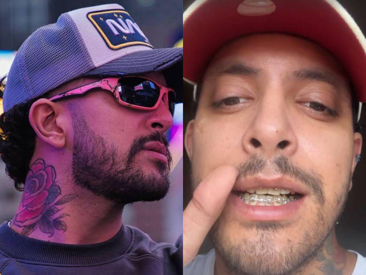 La operación que le cambió la vida: Fancony revela cuánto pagó por su transformación